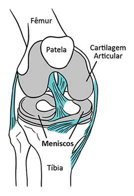 Lesão de menisco